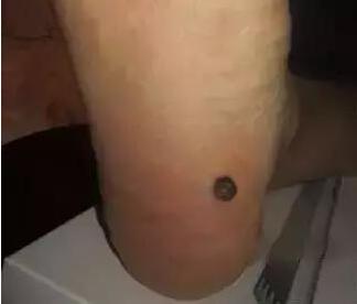 1536045942722.jpg 头疼绝招.jpg