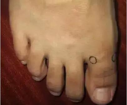 1536046254935.jpg 扁桃体炎绝招.jpg